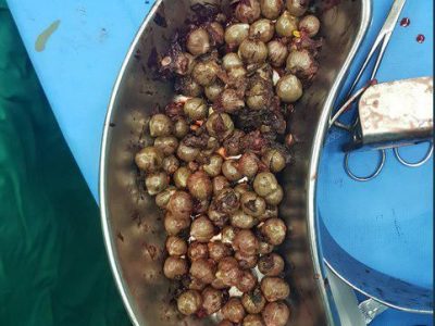 عکس نوشت | کشف ۲۰۰ بسته هروئین از معده ۲ قاچاقچی