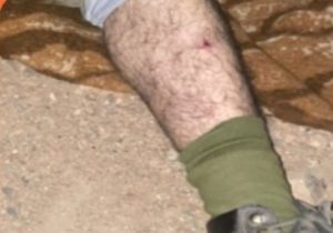 زخمی شدن محیط بان پناهگاه حیات وحش موته با تیراندازی متخلفین شکار