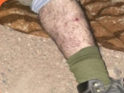 زخمی شدن محیط بان پناهگاه حیات وحش موته با تیراندازی متخلفین شکار