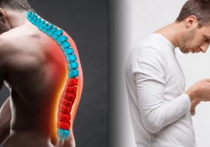 کیفوز یا گوژپشتی چیست؟ / چگونه یک برنامه تمرینی اصلاحی برای بهبود کیفوز طراحی کنیم؟