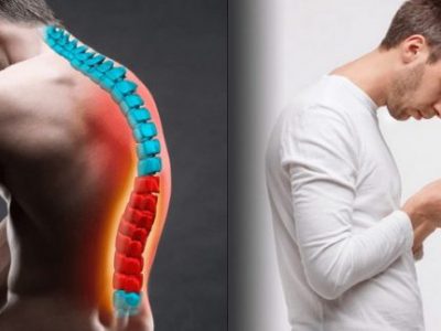 کیفوز یا گوژپشتی چیست؟ / چگونه یک برنامه تمرینی اصلاحی برای بهبود کیفوز طراحی کنیم؟