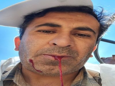 کارشناس واحد بهداشت و مدیریت بیماری های دامی شبکه دامپزشکی شهرستان سمیرم حین انجام خدمت از ناحیه صورت مصدوم و راهی بیمارستان شد