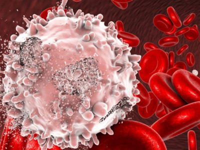 اجرای طرحی با کارایی بالا در درمان بیماری سرطان