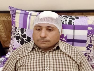 مصدومیت واکسیناتور شبکه دامپزشکی شهرستان نجف آباد از ناحیه سر